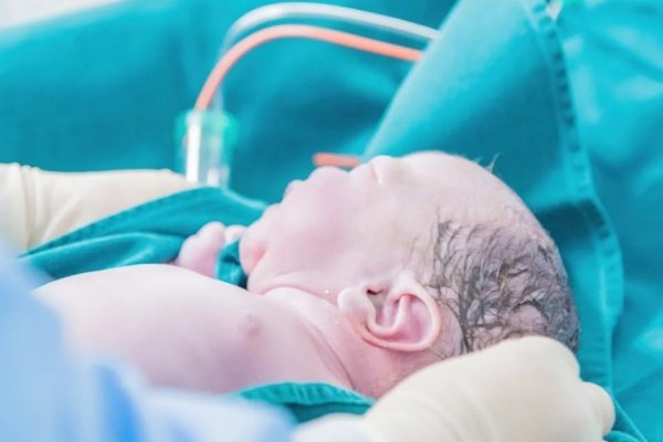 保温箱、NICU费用要单算
